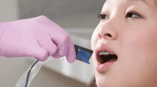 لماذا يعتبر Sensor X-Ray الحجم 1 الخيار الأفضل لأطباء الأسنان في 2025؟ Today Homage
